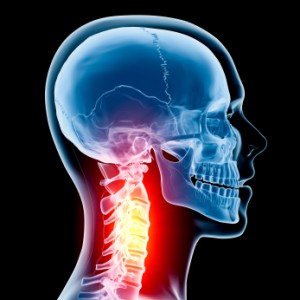 Clinical Decision Making Rule for Cervical Spine Radiography