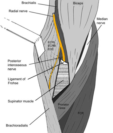 Radial-Tunnel-Syndrome-Anatomy-Sports-Physiotherapy